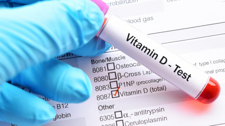 Vitamin D Test Overview